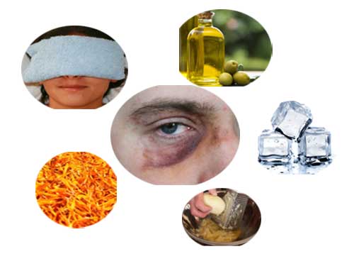 How to Get Gid of Black Eye Fast